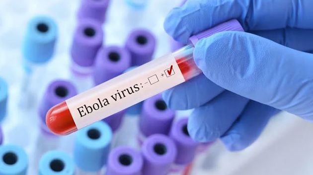 First Ebola case confirmed in France after doctor returns from DRC