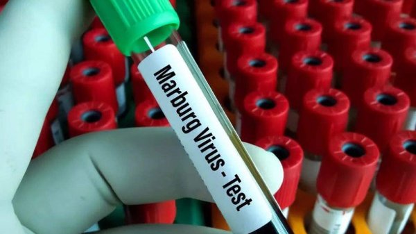WHO says Marburg virus case detected in Uganda
